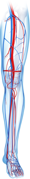 Transparent left leg illustration showing infrainguinal vasculature